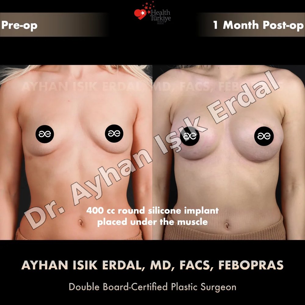 Cosmetic Surgery