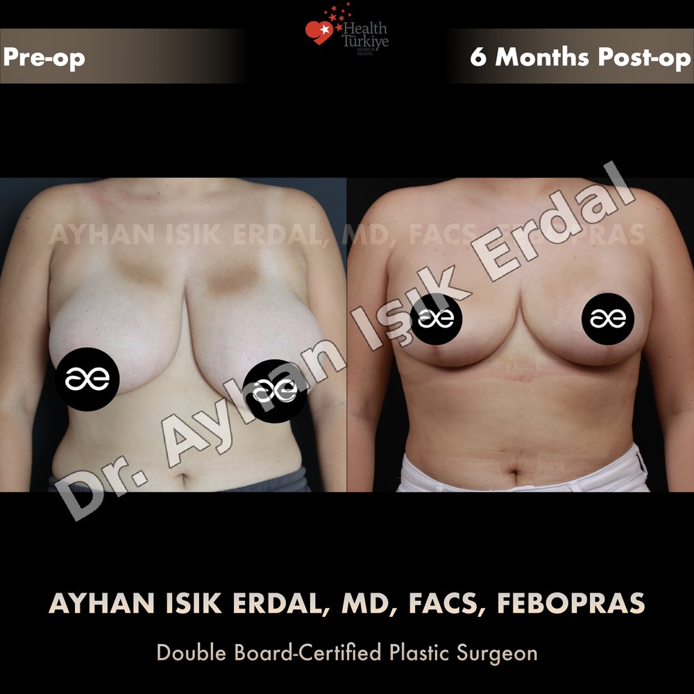 cosmetic surgery journey