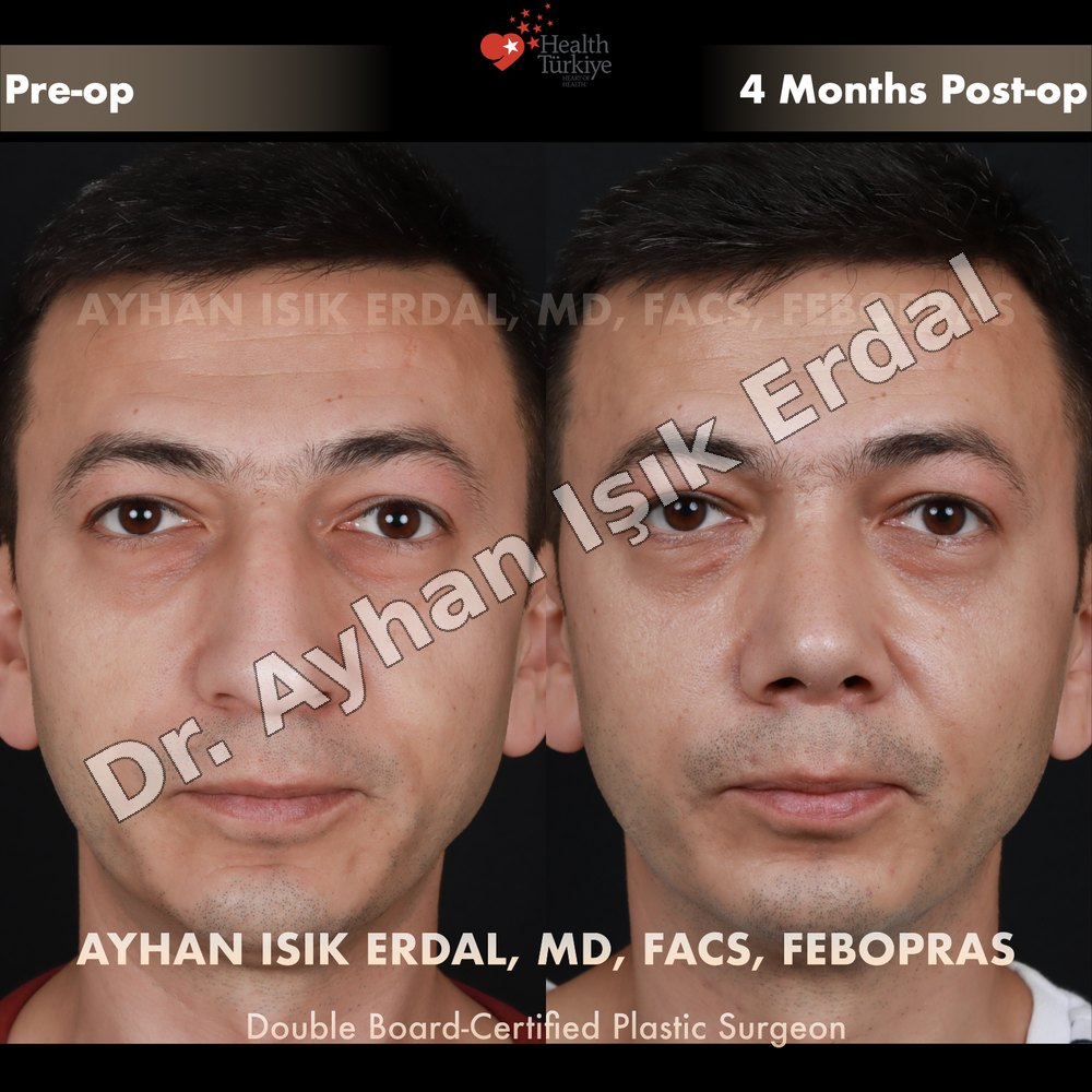 Cosmetic Surgery Procedures